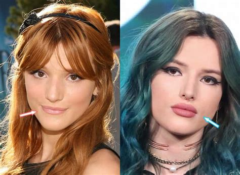 are bella thornes lips fake